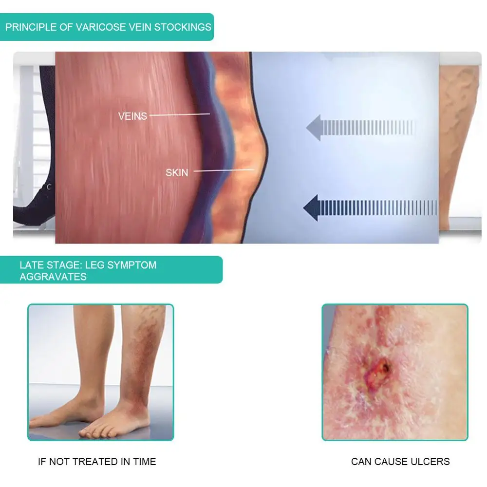 1 Paar Medische Compressie Sok - Compression Calf Sleeve recensie en prijs
